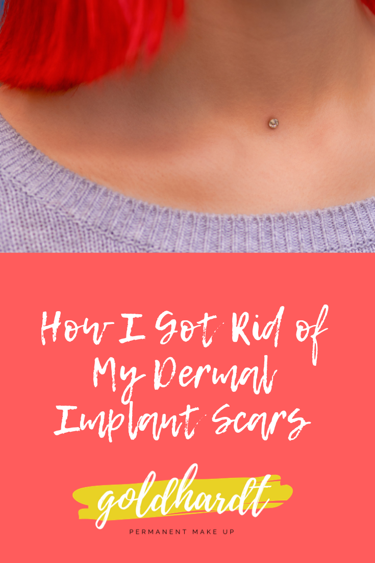How I Got Rid of My Dermal Piercing Scars